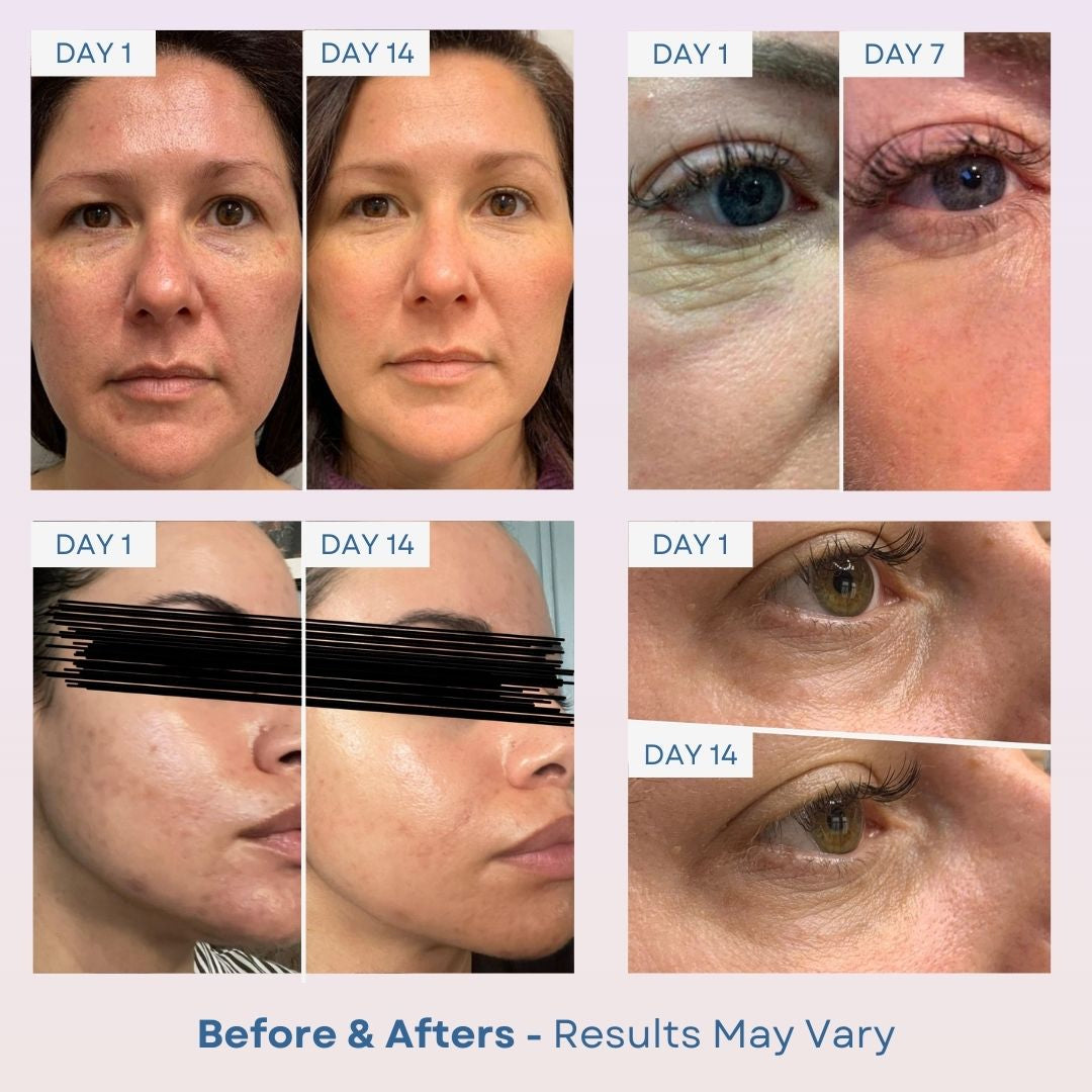 aura-ozie-img-15.jpg__PID:04ded278-7bf7-44c0-bfae-20c13d3fd758