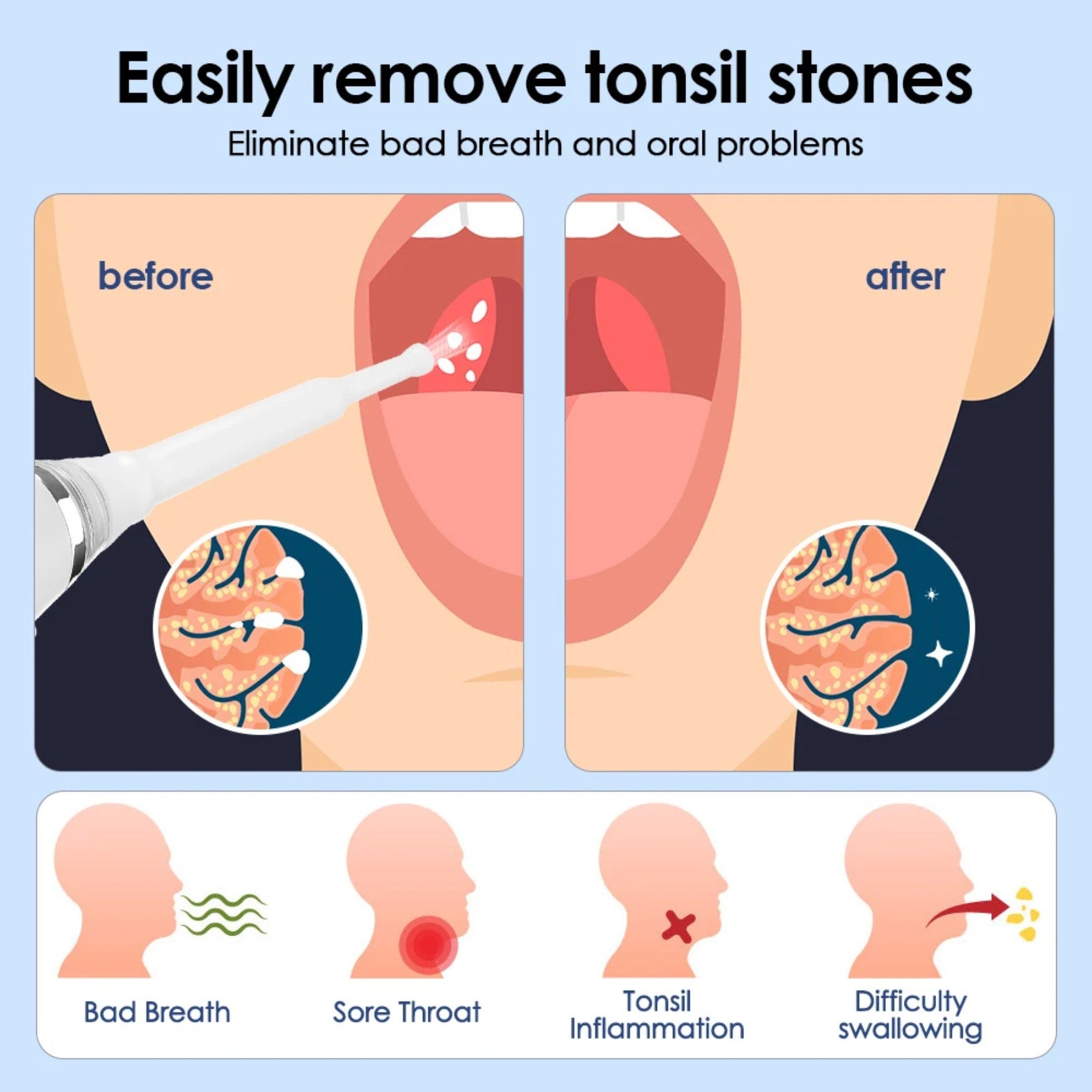 Tonsiliox
